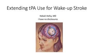 Extending tPA Use for Wake-up Stroke
