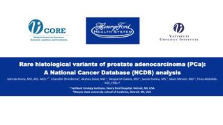 Rare Histological Variants of Prostate Adenocarcinoma (PCa):  NCDB Analysis