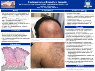 Dupilumab Induced Psoriasiform Dermatitis