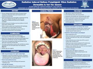 Radiation Induced Bullous Pemphigoid: When Radiation Dermatitis Is Not The Answer