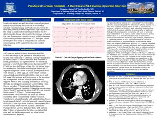 Paradoxical Coronary Embolus-A Rare Cause of ST-Elevation Myocardial Infarction