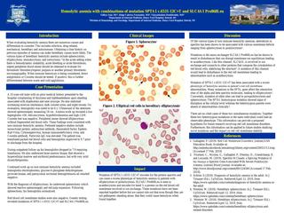 Hemolytic anemia with mutations SPTA1 c.6531-12C>T and SLC4A1 Pro868Leu