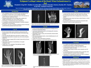 Malignant Cartilage Lesions of the Hand: When Enchondromas Go Bad