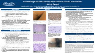 Perianal Pigmented Variant of Dermatofibrosarcoma Protuberans