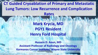 CT Guided Cryoablation of Primary and Metastatic Lung Tumors: Low Recurrence and Complication Rates