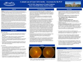 A case of vision loss in a patient with Giant Cell Arteritis