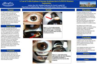 A Case of Uveitis-Hyphema-Glaucoma Syndrome due to ExPRESS Miniature Implantation