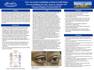 Rare case of gout manifesting as bilateral eyelid lesions