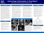 Hemorrhagic Cholecystitis: A Case Report by Tyler Arscott and Lawrence Narkiewicz