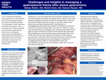 Challenges and insights in managing a gastropleural fistula after sleeve gastrectomy