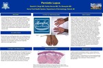 Perniotic Lupus