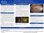 HSV Acute Retinal Necrosis – A Painful Threat to Vision