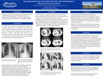 Necrotizing Cavitary Lung Mass in Patient with AIDS: A Rare Manifestation of PCP