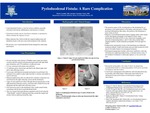 Pyeloduodenal Fistula: A Rare Complication