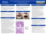 Chronic Peri-Oral Dermatitis as the First Manifestations of Crohn's Disease