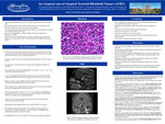 An Atypical Case of Atypical Teratoid Rhabdoid Tumor (ATRT)