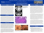 Tuberculous Peritonitis: An Unusual Diagnosis For Vague Abdominal Pain by Zachary Ciochetto and Michel Hanna