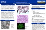 C3 Glomerulonephritis: A Rare Case of GN