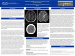 Tumefactive Multiple Sclerosis, an Uncommon Variant with Several Mimics