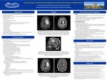Psychotic Features and Behavioral Dysregulation in a Patient with Tumefactive Multiple Sclerosis